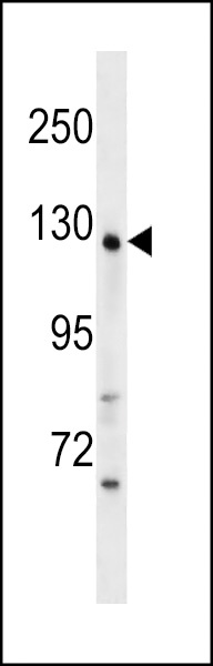 WDR64 Antibody