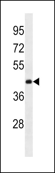 ANKRD63 Antibody