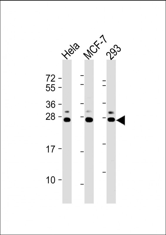 KDELR1 Antibody