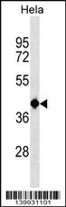 TSEN2 Antibody