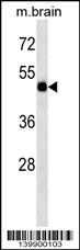 TBC1D10A Antibody