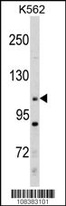 MLLT10 Antibody