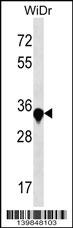 AMMECR1 Antibody