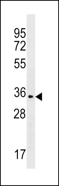 OR2T35 Antibody