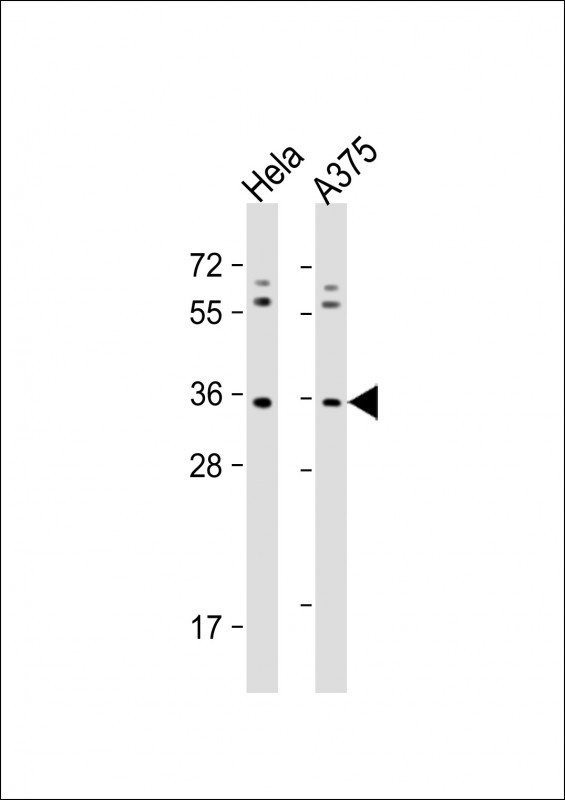 OR5AK2 Antibody