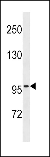 ZNF229 Antibody