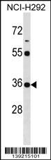 KCTD17 Antibody