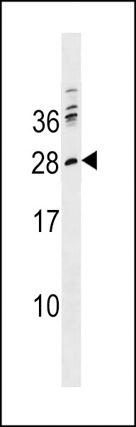 PTCRA Antibody