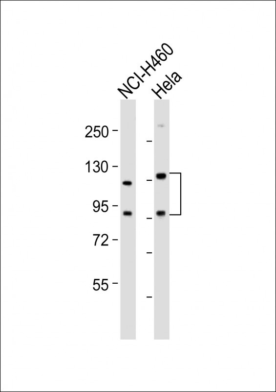 SLCO1B3 Antibody