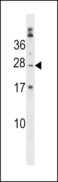 PABPC1L2B Antibody