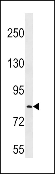 LRRC70 Antibody