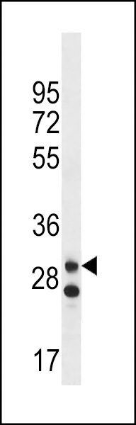LRRC3C Antibody