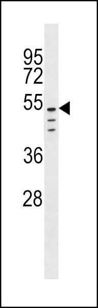 CLEC18C Antibody