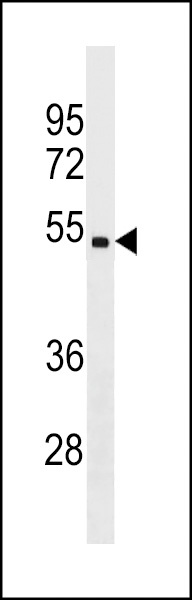 CHST5 Antibody