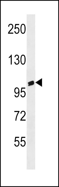 ANKRD20A3 Antibody