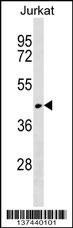 RUNDC3A Antibody