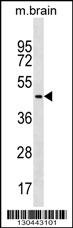 FAF2 Antibody