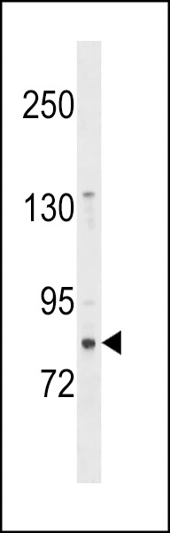 ZNF853 Antibody