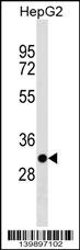 TARM1 Antibody