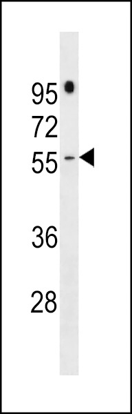 PRAMEF16 Antibody