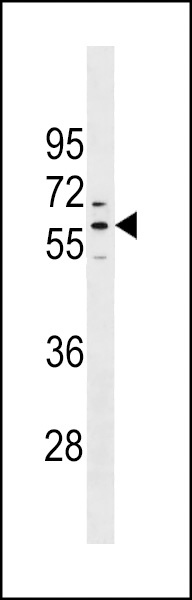 PRAMEF1 Antibody