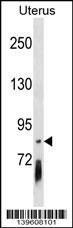 PCDHGB4 Antibody