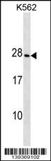 CRYGD Antibody