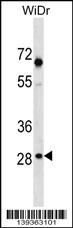 SNX11 Antibody