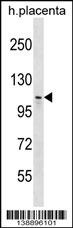 MMS19 Antibody