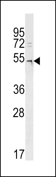 DCAF12L2 Antibody