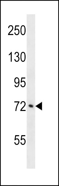 ATXN1L Antibody