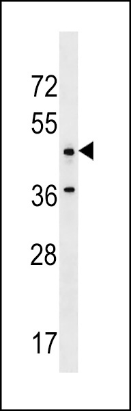 ANKRD61 Antibody