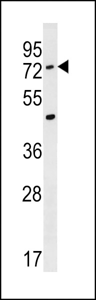 ACSM2A Antibody