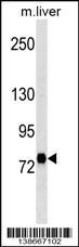 Stra6 Antibody