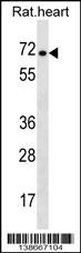 Stra6 Antibody