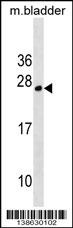 TPD52L1 Antibody