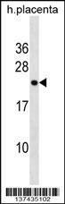 RNF122 Antibody