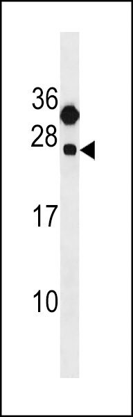 CLEC6A Antibody