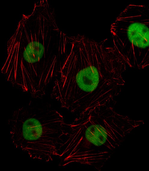 HOXD8 Antibody