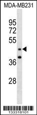 GRAMD3 Antibody