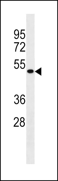 IDAS Antibody