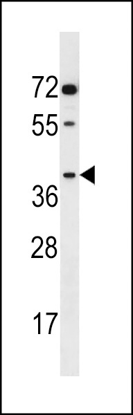 AKR1E2 Antibody