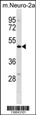 Mouse Dcdc2 Antibody