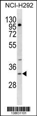 TREML1 Antibody