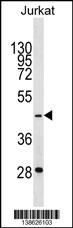 GTF3A Antibody