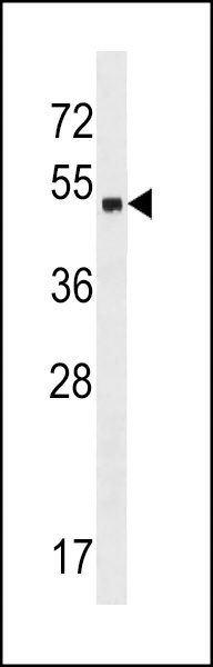 ZNF559 Antibody