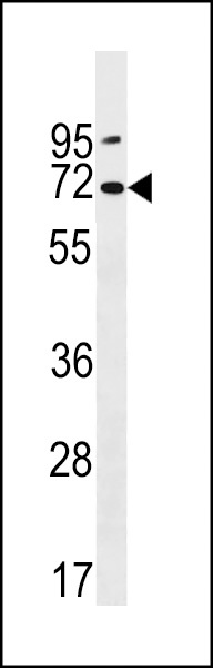 PKD2L2 Antibody