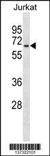 GALNT14 Antibody