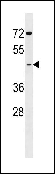 GCNT7 Antibody