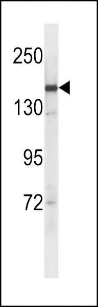 SYCP2 Antibody